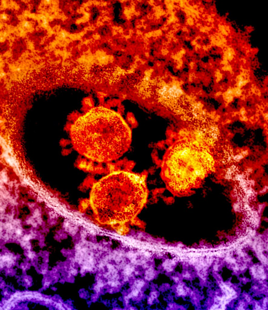 "MERS Coronavirus Particles" by National Institutes of Health (NIH) is licensed under CC BY-NC 2.0